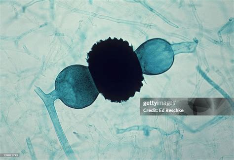 Rhizopus Sporangium