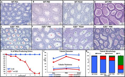 E2f1 Null Mice Exhibit Progressive Infertility Testicular Atrophy And Download Scientific