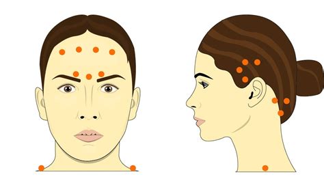 Botox Injections For Migraines