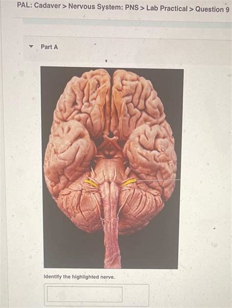 Solved PAL Cadaver Nervous System PNS Lab Practical Chegg