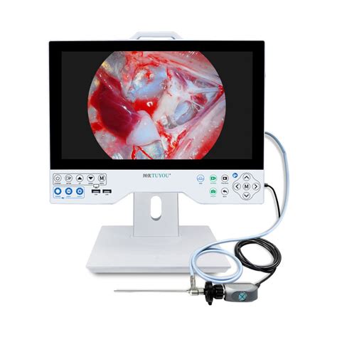 Medical Endoscope 15 6 Inches Integrated Endoscopy Camera System With