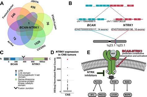 Targetable Ntrk Fusion Identified In An Infiltrating Glioma A The