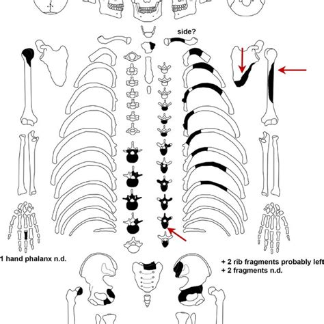 The Preserved Skeletal Remains From The Helmsdorf Burial The Bone