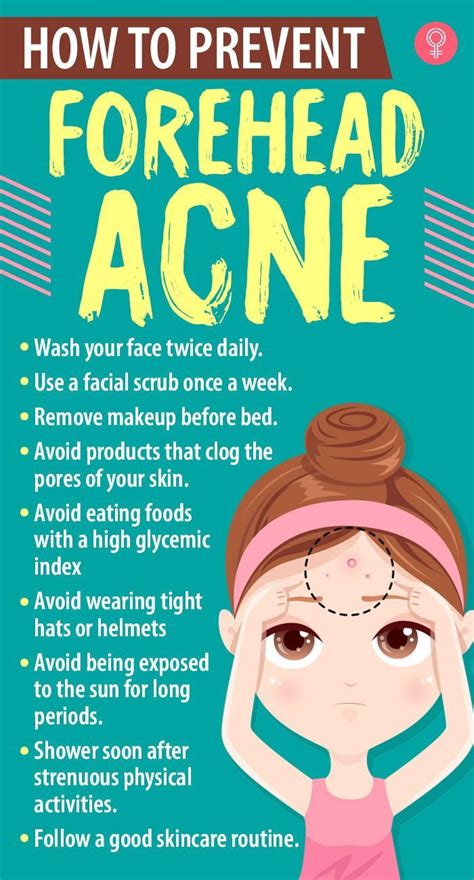 How To Prevent Forehead Acne Artofit