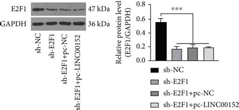 Linc00152 Overexpression Diminishes The Repressive Role Of E2f1