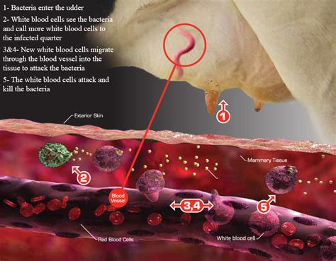 Mastitis Icbf