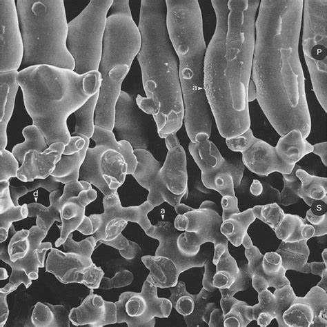 Method 6 Detail Of A Spongy Mesophyll Cell Surface From The Specimen