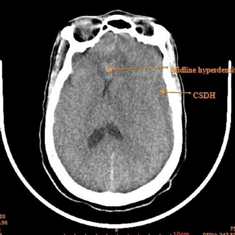 Preoperative Computed Tomography Download Scientific Diagram