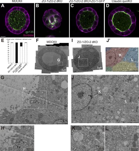 JCellBiol On Twitter Otani Et Al Found That The Scaffolding Proteins