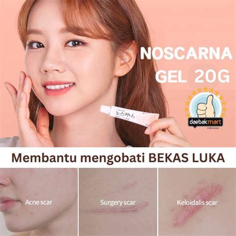 Jual Ready Stock Noscarna Gel 20g Original Korea Salep Bekas Luka