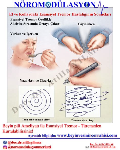 N Romod Lasyon Merkezi Beyin Pili Baklofen Do Dr Atilla Yilmaz