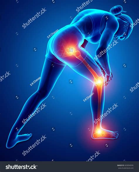 3d Illustration Women Leg Joint Pain Stock Illustration 603094595