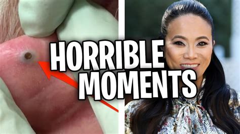 The Grossest And Most Disgusting Moments On Dr Pimple Popper Youtube