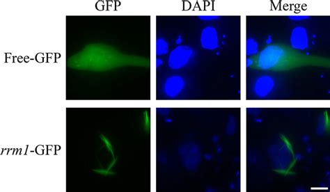 Subcellular Localization Of Fusion Protein Of RRM1 EGFP In SB Cells