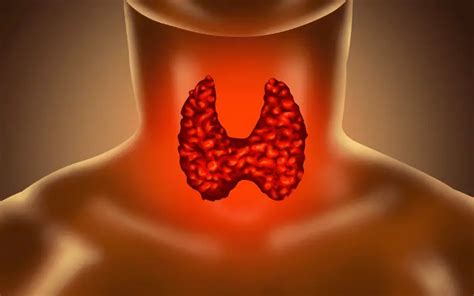 Thyroid Cancer Recurrence The 5 Symptoms You Need To Know