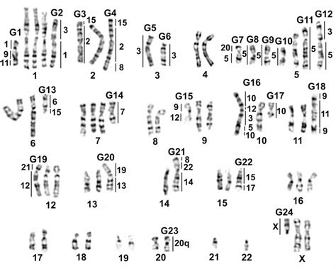 The G Banded Karyotype Of Glc 82 Cell Line The Number Of Normal Download Scientific Diagram