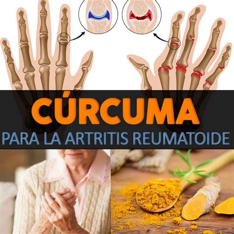 Remedios Naturales Para La Artritis Que Realmente Funcionan Remedios