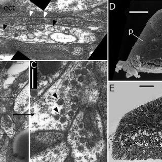 Morphology and histology of a Gonothyraea loveni planula. Arrowheads... | Download Scientific ...