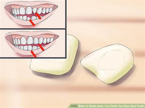 3 Ways to Smile when You Think You Have Bad Teeth - wikiHow