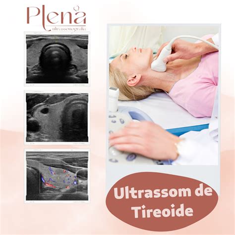 Ultrassom De Tireoide Plena Ultrassonograf