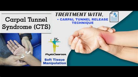 Carpal Tunnel Release Technique Soft Tissue Manipulation Technique To