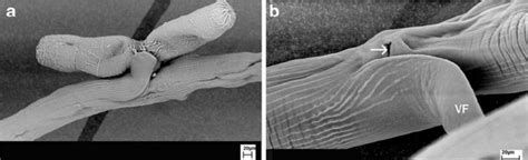 Scanning Electron Micro Graph Of The Female O Occidentalis Showing