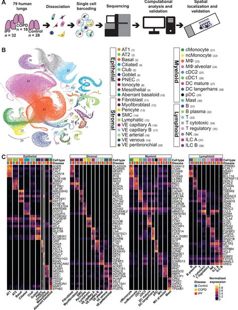 Single Cell Rna Seq Reveals Ectopic And Aberrant Lung Resident Cell