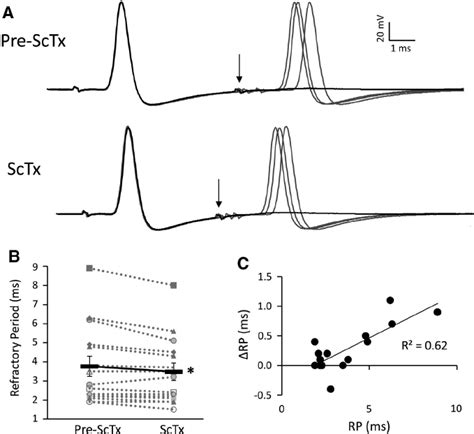 Sctx Treatment Shortens The Refractory Period Of Drg Neurons A