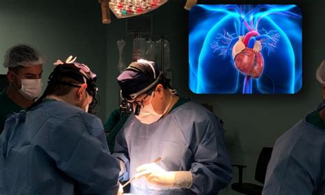 Quanto Custa Um Transplante De Coracao - Cada transplante de coração no Brasil custa em torno R$ 37 mil para o ...