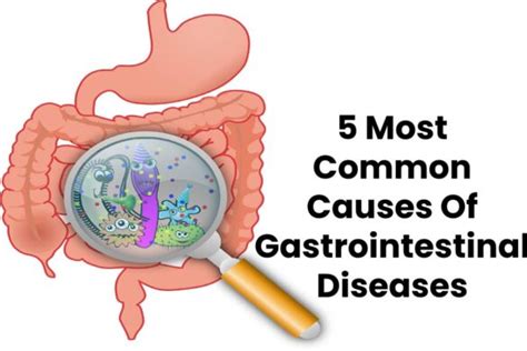 5 Most Common Causes of Gastrointestinal Diseases [2023]