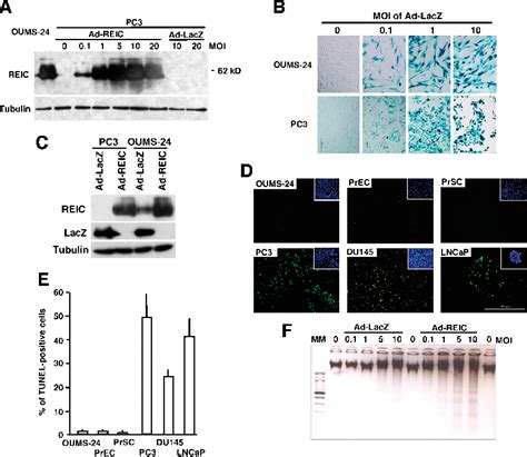 Figure From Adenovirus Mediated Overexpression Of Reic Dkk