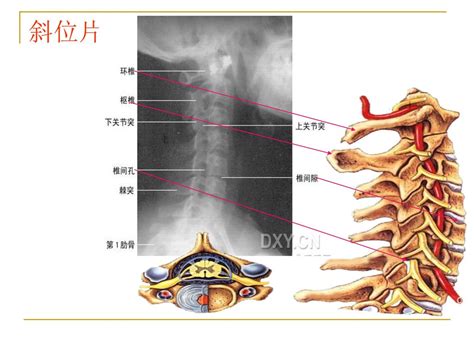 颈椎x线诊断 平高医院康复科 赵铎 Ppt Download