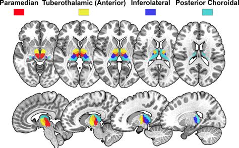 Three Dimensional Vascular Maps Of The Thalamus Stroke