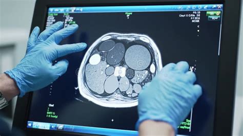 Healthcare Professional Examines Medical Imaging Of A Patients