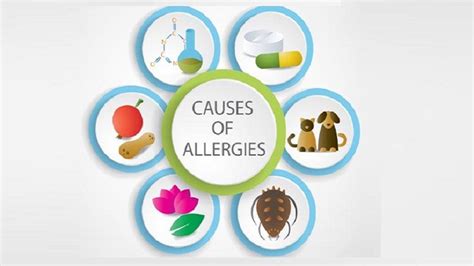 Allergy Causes Symptoms And How To Manage Helal Medical