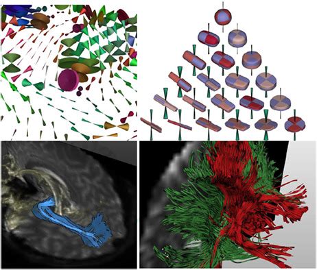 Diffusion Mri Of The Brain The Naked Truth Nmr In Biomedicine Vol