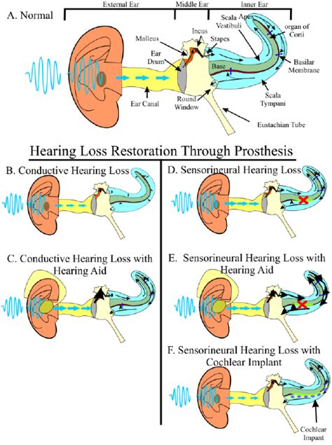 Hearing Requires The Precise Stimulation Of Hair Cells Sound Waves