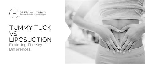 Tummy Tuck Vs Liposuction Exploring The Key Differences