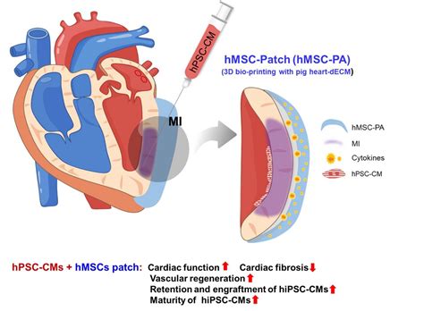 Novel dual stem cell therapy improving cardiac regeneration