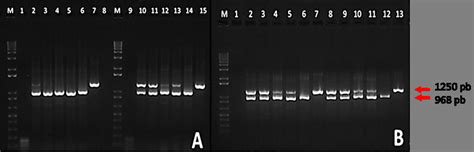 Resultados De La Electroforesis En Un Gel De Agarosa A Que