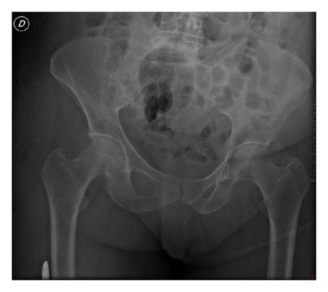 Postoperative X Ray Examination Download Scientific Diagram