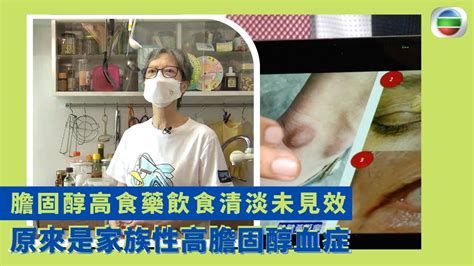 健康360 Tvb｜膽固醇高食藥飲食清淡未見效 原來是家族性高膽固醇血症 5年要3次通波仔手術心血管裝10個支架 患者肝臟不能吸收壞膽固醇因