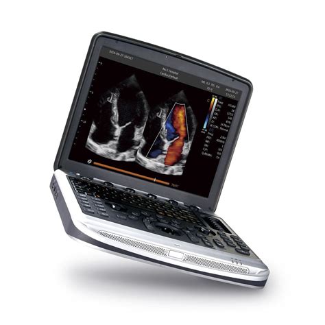 Aparelho De Ultrassom Port Til Sonobook Chison Medical