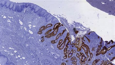 Pathology Outlines Case 256