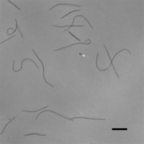 Phase-contrast micrograph of cells of strain YM11-185 T. Bar, 10 mm ... 