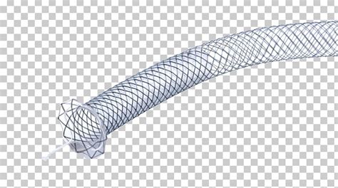 Stenting Common Bile Duct Medicine Self-expandable Metallic Stent PNG, Clipart, Angle, Baremetal ...