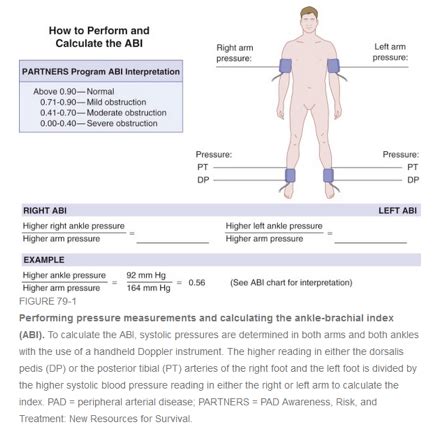 Peripheral Vascular Disease Flashcards Quizlet