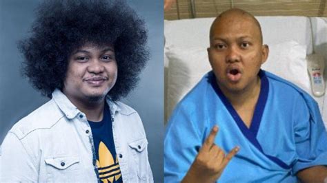 Riwayat Sakit Babe Cabita Sempat Terkena Dbd Sebelum Didiagnosis