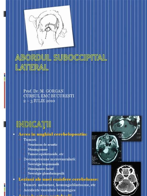 PDF Abordu Suboccipital Lateral DOKUMEN TIPS