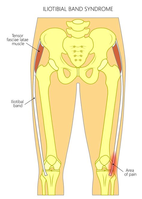 Two Minutes Of Anatomy Iliotibial Band IT Band ITB Iliotibial Tract